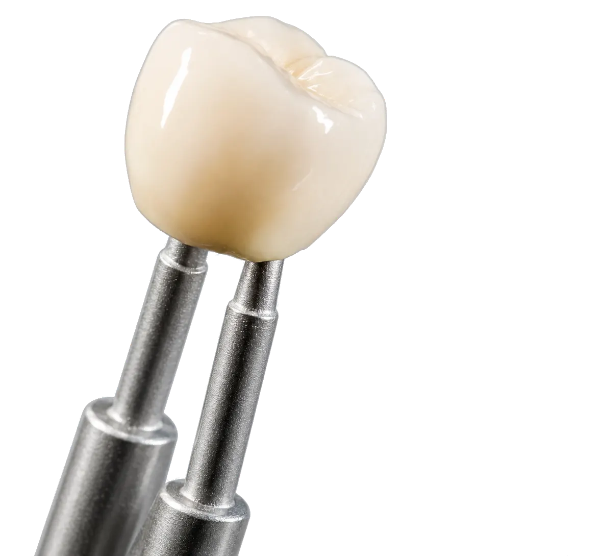 Couronne dentaire en céramique tenue à la précelle à la Zirconia Dental Clinic, Birkhadem, Alger