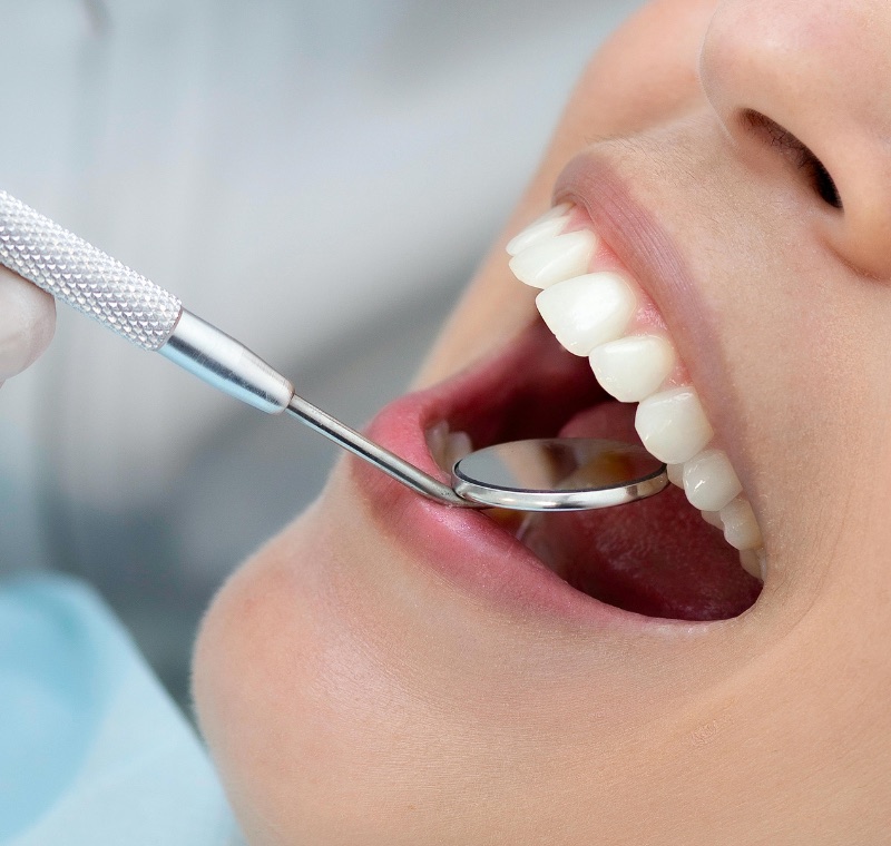 Examen dentaire de contrôle au miroir — soins et prévention à la Zirconia Dental Clinic, Birkhadem, Alger